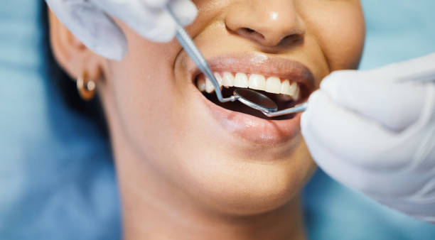 Laser Dentistry in Livingston, LA